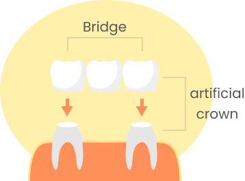 Dental Service Img